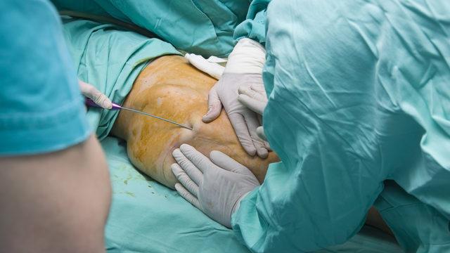 Ünlü şarkıcının karısı hayatını kaybetti! Estetik operasyonları ne kadar güvenli?