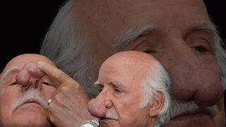 2 yıl önce oluşmaya başladı, burnunu kurcalayıp bu hale geldi! 100 gram ağırlığında