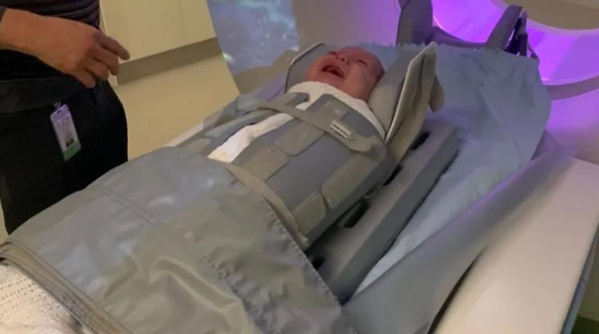 Annesinin hatası yüzünden ölümden döndü! Minicik bebeğin kafatası kırıldı