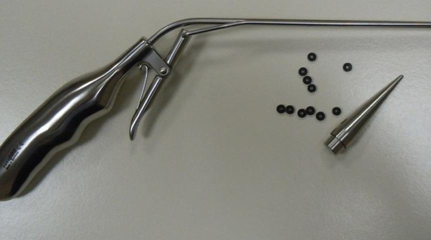 Hemoroid (basur) i&ccedil;in ameliyatsız boğma tedavisi