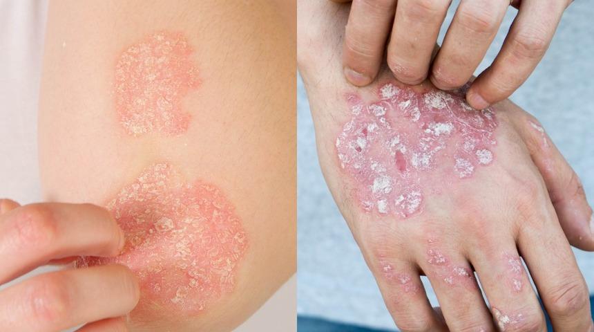 Egzaması olanları uyardılar! Büyük risk altındalar