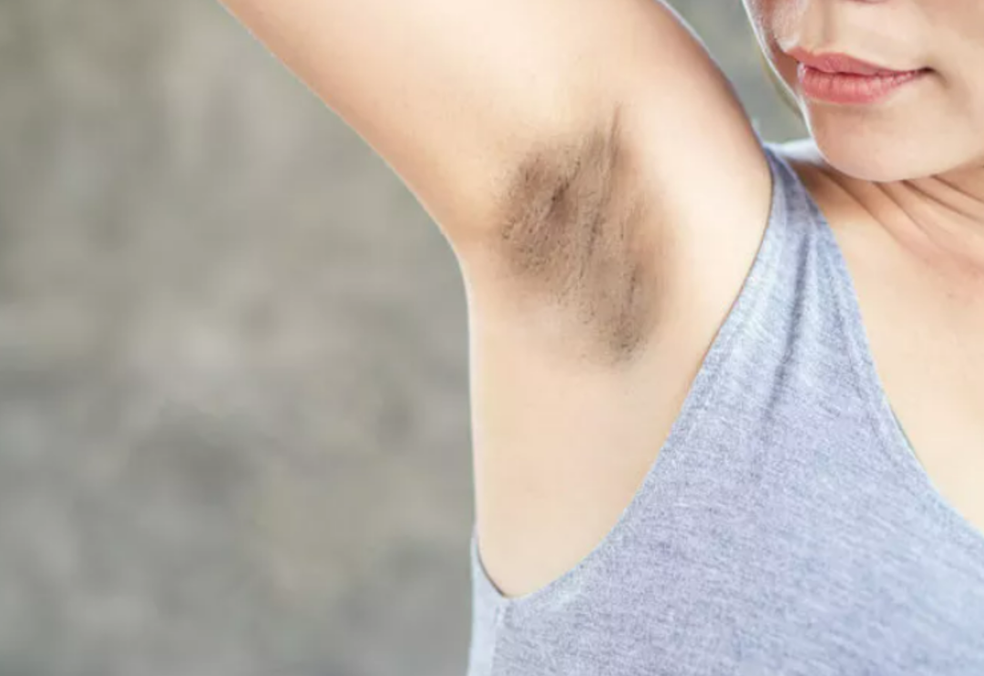 Cildinizi beyazlatacak maske tarifi! Cilt kararmaları neden olur, nasıl ge&ccedil;er?