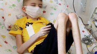 Türkiye günlerce onu konuştu! Çöp evde bulunmuştu, 20 kiloya çıktı