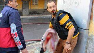 Diyarbakır'da çatışmalar şiddetlendi! Yaralı polis ve vatandaşlar var