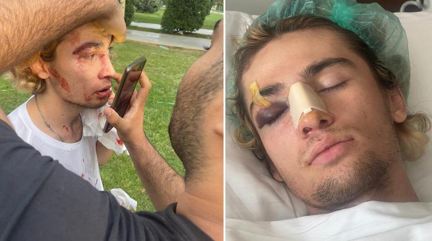 Kaykay şampiyonu milli sporcuya öldüresiye dayak! Sebebi 'pes' dedirtti