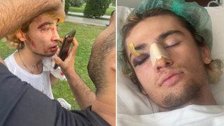 Kaykay şampiyonu milli sporcuya öldüresiye dayak! Sebebi 'pes' dedirtti