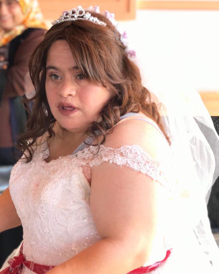 Gaziantepli down sendromlu kızın düğün hayali gerçek oldu G3