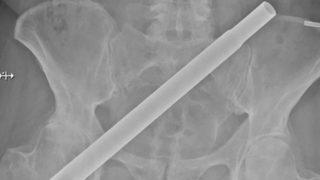 Süsleme yaparken hayatından oluyordu! Başına gelenler…