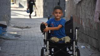 Adanalı 8 yaşındaki Muhammed protez bacakla yürüyecek