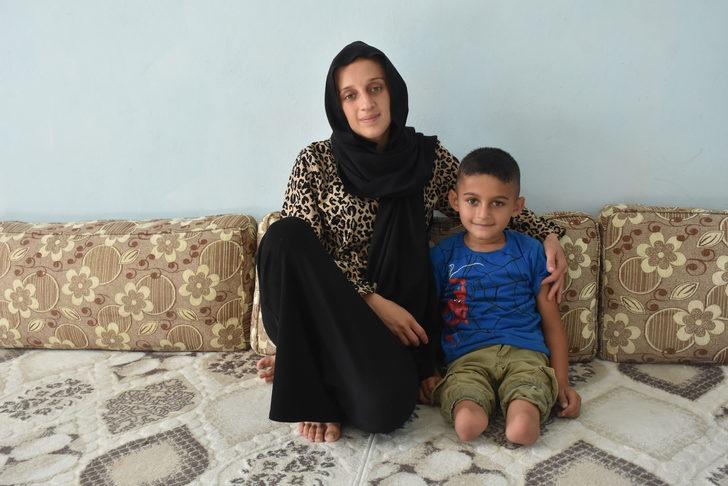 Adanalı 8 yaşındaki Muhammed protez bacakla yürüyecek G3