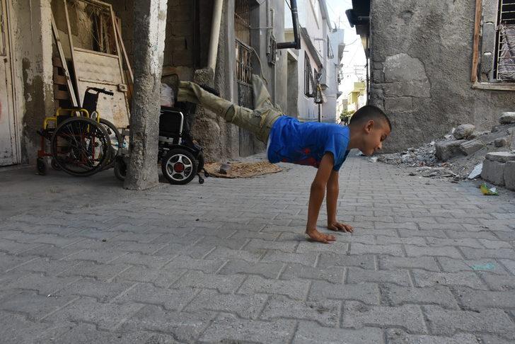Adanalı 8 yaşındaki Muhammed protez bacakla yürüyecek G5