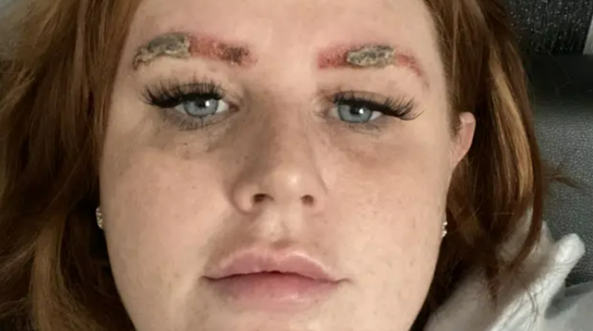 Yeni trend alarm veriyor! Kaşını boyadığı i&ccedil;in canından oluyordu, Anafilaktik şok nedir?