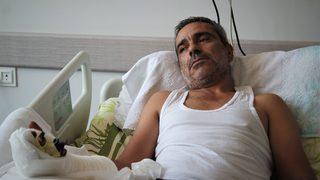 Bursa'da bir işçinin kopan parmakları 10 saatlik operasyonla yerine dikildi