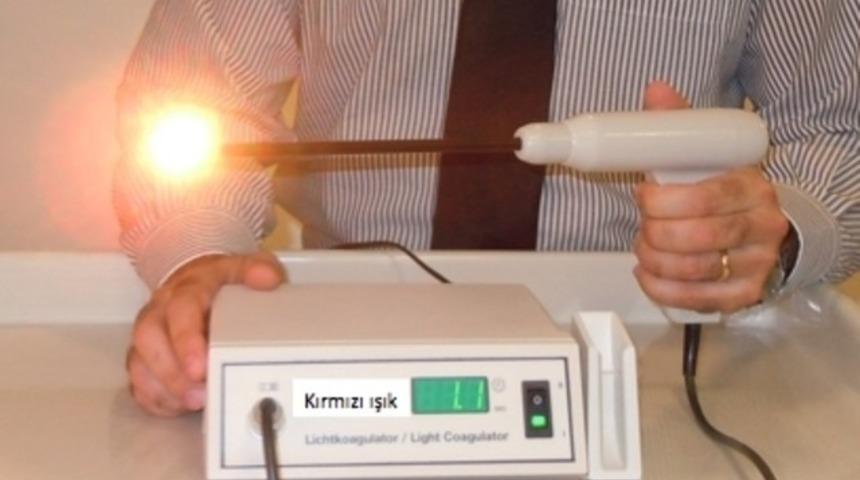 Hemoroid (basur) için ameliyatsız infrared koagülasyon tedavisi