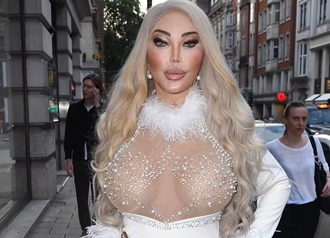 Onu herkes &ccedil;ok iyi tanıyor! Jessica Alves estetikle bambaşka biri oldu