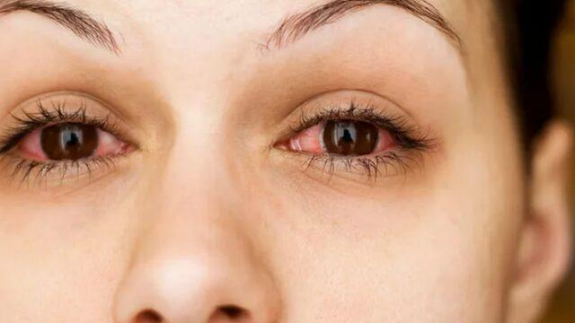 Uzmanlar uyardı! Kirpiklerinize bunları yapmanız enfeksiyona yol açıyor