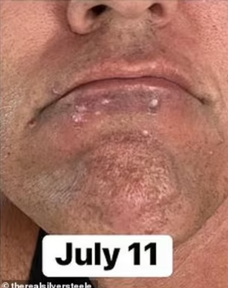 Yardım çığlığı yürekleri burkmuştu... Verdiği yaşam savaşından korkunç fotoğraflar yayınladı G1