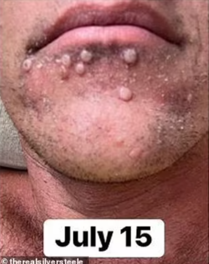 Yardım çığlığı yürekleri burkmuştu... Verdiği yaşam savaşından korkunç fotoğraflar yayınladı G2