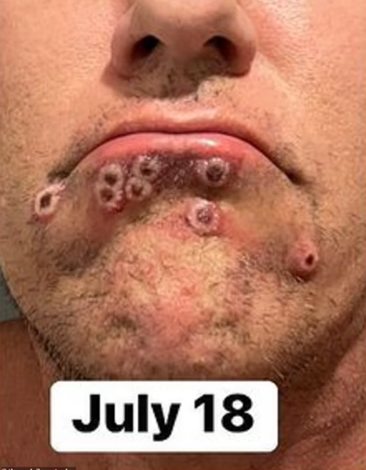 Yardım çığlığı yürekleri burkmuştu... Verdiği yaşam savaşından korkunç fotoğraflar yayınladı G3