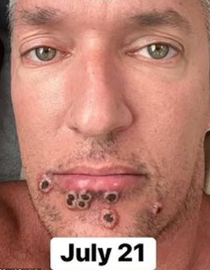 Yardım çığlığı yürekleri burkmuştu... Verdiği yaşam savaşından korkunç fotoğraflar yayınladı G4