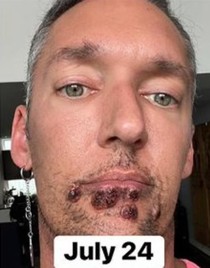 Yardım çığlığı yürekleri burkmuştu... Verdiği yaşam savaşından korkunç fotoğraflar yayınladı G5