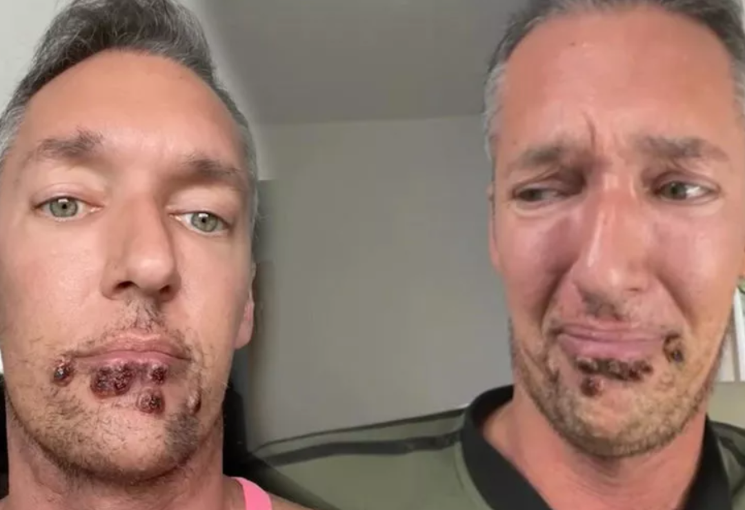 Yardım &ccedil;ığlığı y&uuml;rekleri burkmuştu... Verdiği yaşam savaşından korkun&ccedil; fotoğraflar yayınladı