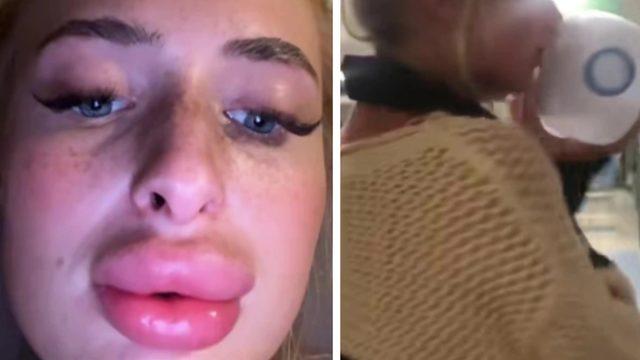 Herkesi uyardı! “Güneş kremi sürmediğim için...”