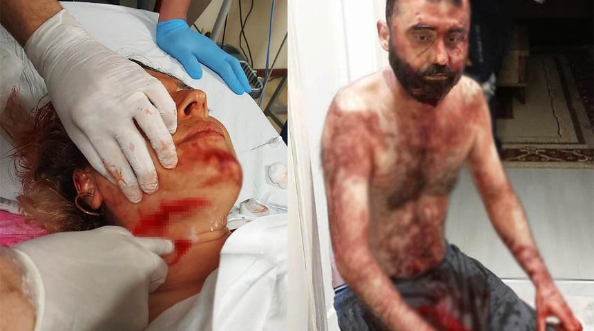 Antalya'da eski kocanın falçatalı dehşetine 40 yıl hapis istemi! 'Başınızda ölmenizi bekleyeceğim'