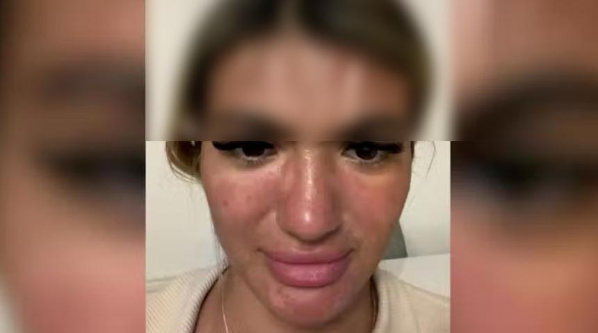 Plastik gibi eridi: Uyandığında fark etti! Gözlerine inanamadı