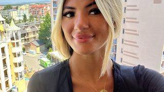 Güneşlenirken uykuya daldı! Uyanınca aynaya baktığında gördüğüne inanamadı