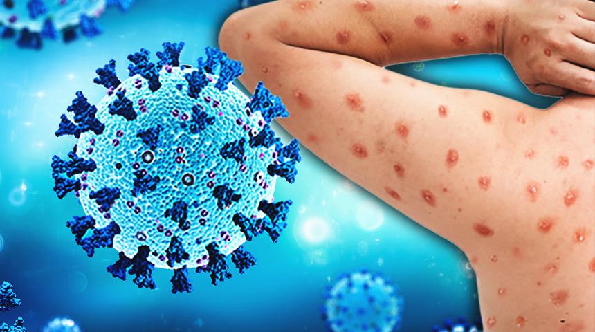 Hedefindeki yaş grubu korkuttu! Yeni salgın patlak verdi: Domates gribi yayılırken gelen uyarı endişelendirdi