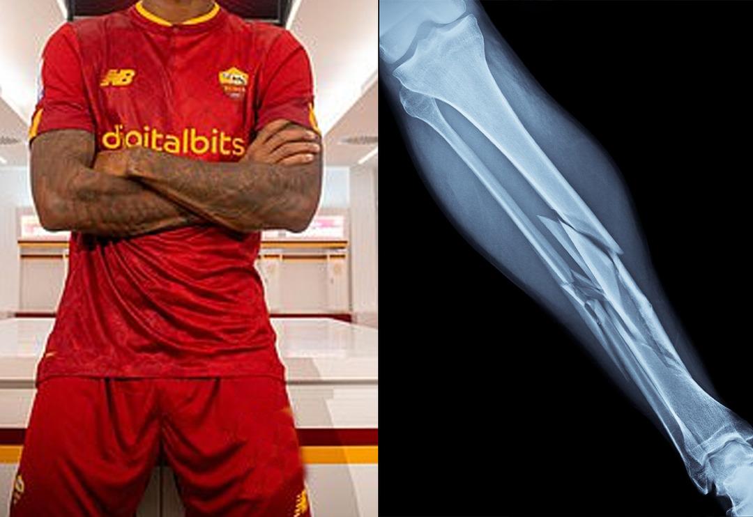 Milli yıldız şokta! Yeni transferin ayağı kırıldı