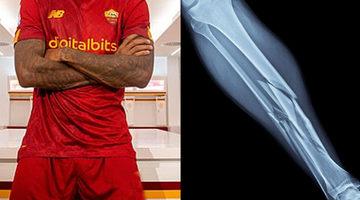 Milli yıldız şokta! Yeni transferin ayağı kırıldı