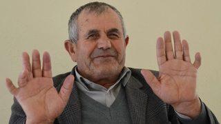 24 parmağıyla herkesi şaşırtıyor