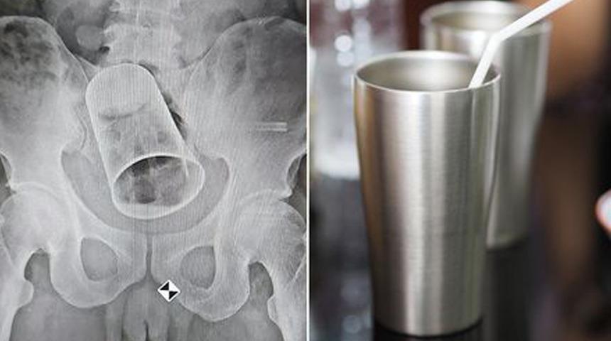 Olmaz olsun böyle arkadaş: Hep beraber soktular! Sonrasında...