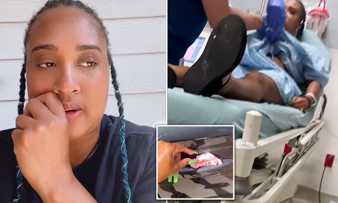 Arabasının kolunda g&ouml;rd&uuml;, sadece 5 dakika dokundu! Pe&ccedil;eteden zehirlenen kadın dehşeti yaşadı