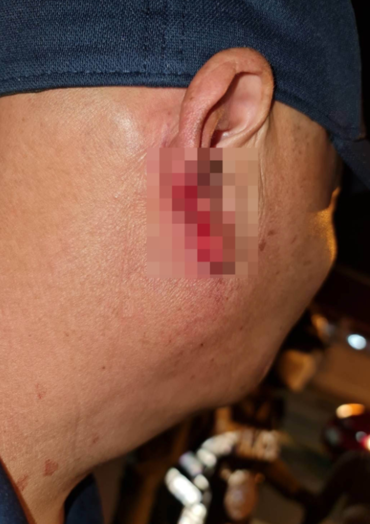 Sarhoş seks işçisi öpme bahanesiyle yaklaştığı turistin kulağını kopartıp yedi! Görenler şaşkınlığını gizleyemedi G4