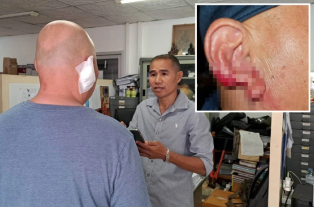 Sarhoş seks iş&ccedil;isi &ouml;pme bahanesiyle yaklaştığı turistin kulağını kopartıp yedi! G&ouml;renler şaşkınlığını gizleyemedi