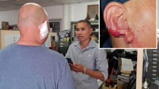 Sarhoş seks işçisi öpme bahanesiyle yaklaştığı turistin kulağını kopartıp yedi! Görenler şaşkınlığını gizleyemedi