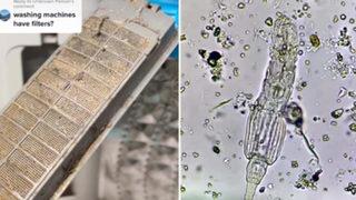 'Asla yeterince temizlenmiyor': Mide bulandıran görüntüler