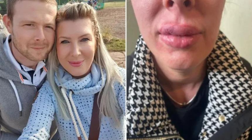 Güzellik sevdası başına bela oldu! 1 yıl boyunca aynalara bakamadı