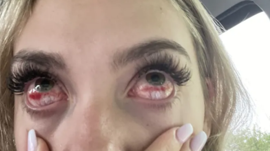 Sadece ipek kirpik yaptırmak istemişti! Talihsiz kadının başına gelenler korkuttu