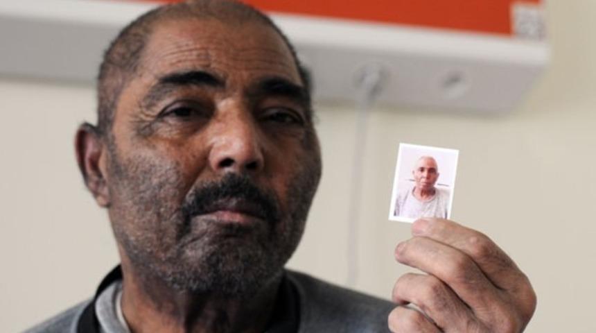 Ak düşen saçları 58'inden sonra siyahlaştı