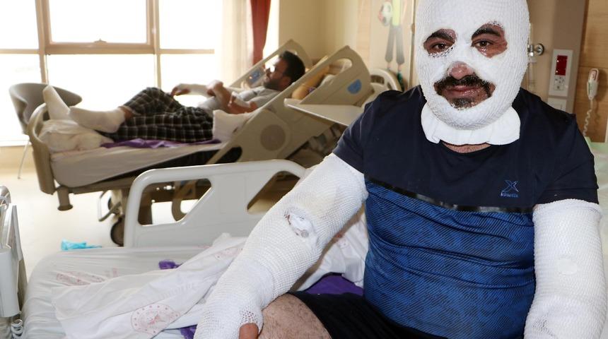 Otogaz bakım dükkanında patlama oldu tanınmaz hale geldiler: Acı hissetmiyordum