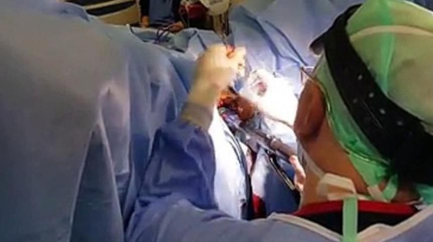 Hemoroid (basur) için Longo ameliyatı