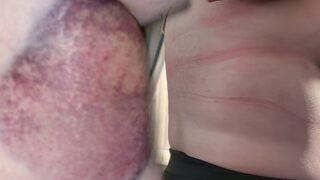 En büyük felaketi düğün günü yaşadı: Sütyen takamıyor, duş bile alamıyor! “Her yerimde varmış gibi”