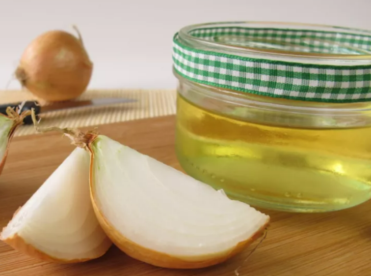 Yazın en sık görülen hastalık! İdrar yolu enfeksiyonunu geçirmek için yemeniz gerekenler G2