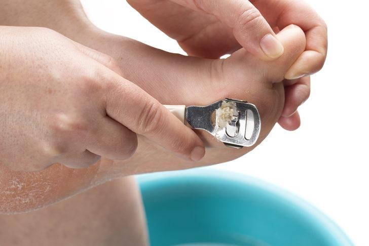 Ayaklara yapılan en büyük kötülük! Verdiği zararı bir bilseniz... G5