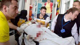 Barajda mayın patladı: 1 yaralı