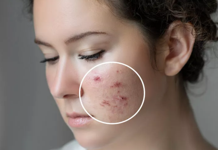 Artık çöpe atmayın: Kavun çekirdeğinin faydaları saymakla bitmiyor! Kansızlığı, öksürüğü, saç dökülmesini önlüyor! G3